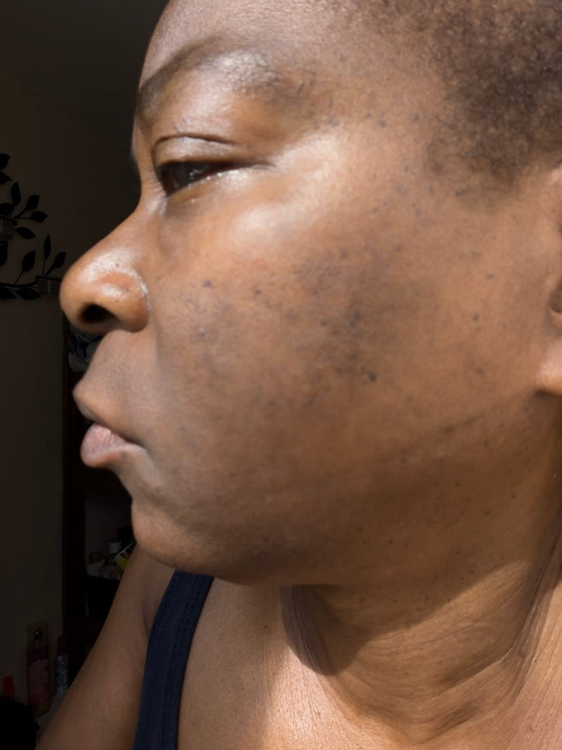 Customer after photo, supplied and authorised by Glowmela