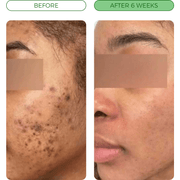 Customer before-and-after comparison 1