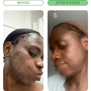 Customer before-and-after comparison 2
