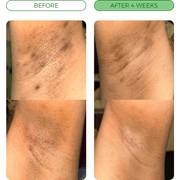 Customer before-and-after comparison 3