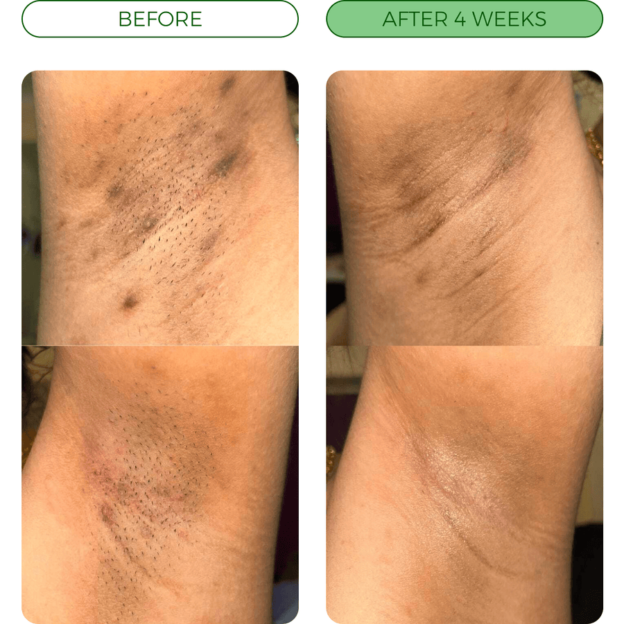 Customer before-and-after comparison 3
